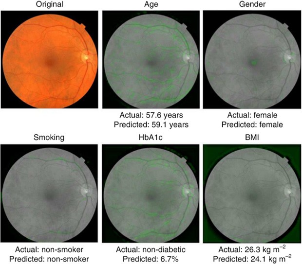 Le immagini della retina analizzate dal sistema di machine